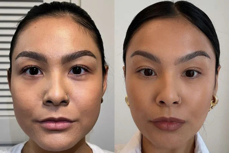 Before_and_after_review_8.webp