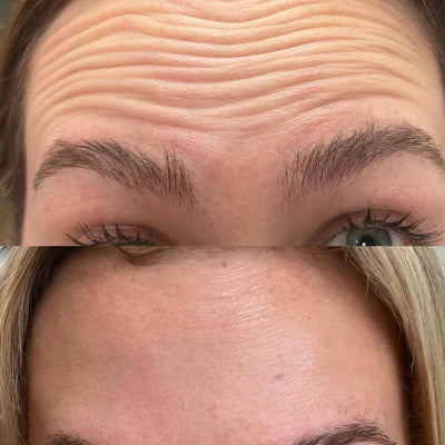 fixed_wrinkles_400x_1bfbe05c-d10e-4fc1-8f74-c7fe0ffaccdd.webp